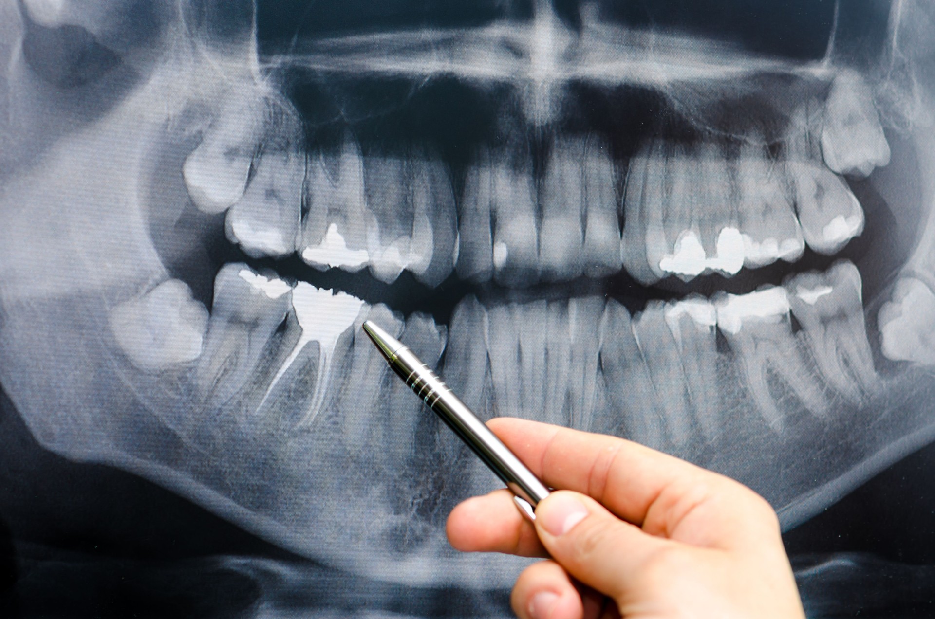 Dentista mostrar algo en dental imagen de rayos x