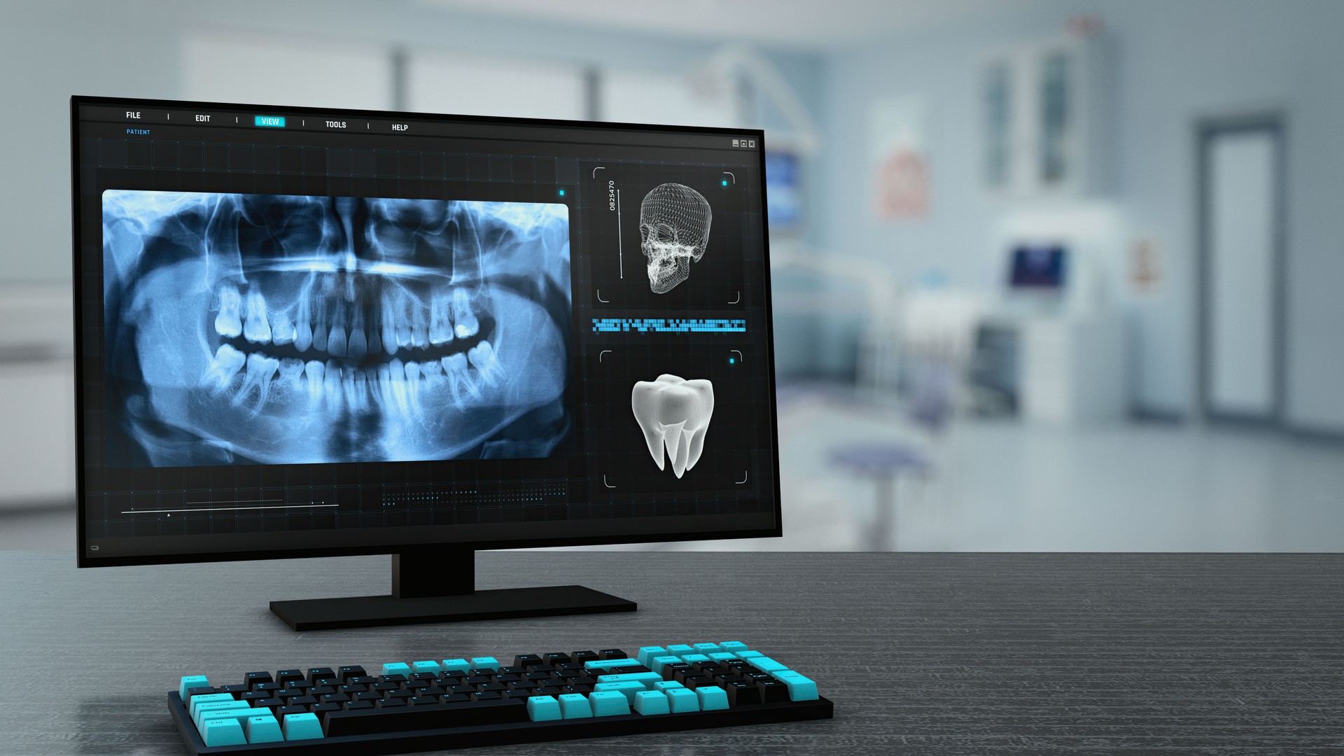 Dental tomography CT scan Xray monitor